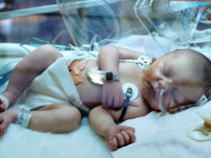 Kami Sutton just 2 days old in the Intensive Care Unit at Seattle Children's 