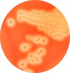 An image of the common bacteria Group B Streptococcus. 