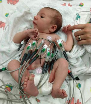 A baby with multiple sensors attached to the body.