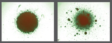 On the left is a microscopic image of thousands of HIV-infected cells after being exposed to normal, unedited T cells. On the right is a microscopic image of HIV-infected cells after being exposed to T cells edited by Drs. Rawlings and Scharenberg. The clumping in the image to the right indicates HIV positive cells are being killed by the edited T cells.