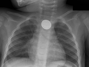 button_battery_X-ray-x-large