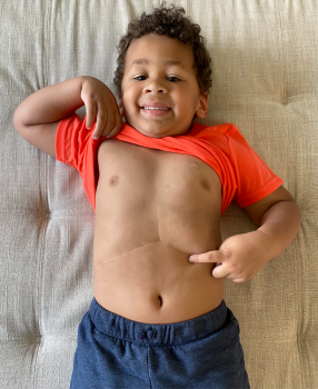 Isaac proudly shows off his “Superman scar” on his stomach.